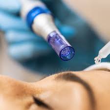 Delasco Microneedling Treatment at Malama Dermatology in Honolulu 1